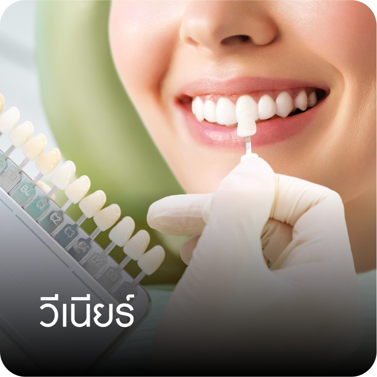 วีเนียร์ คลินิกทันตกรรมบ้านสวน