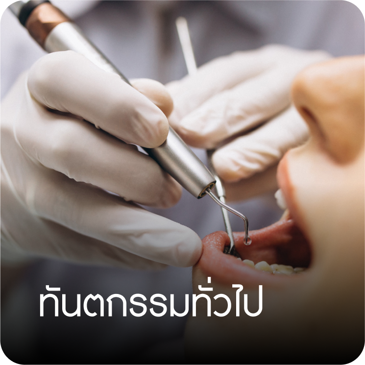 ทันตกรรม คลินิกทันตกรรมบ้านสวน