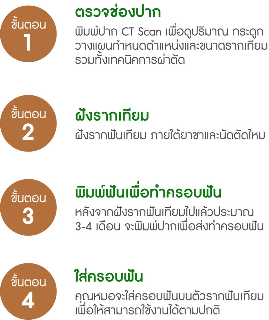 ขั้นตอนการทำ รากฟันเทียม